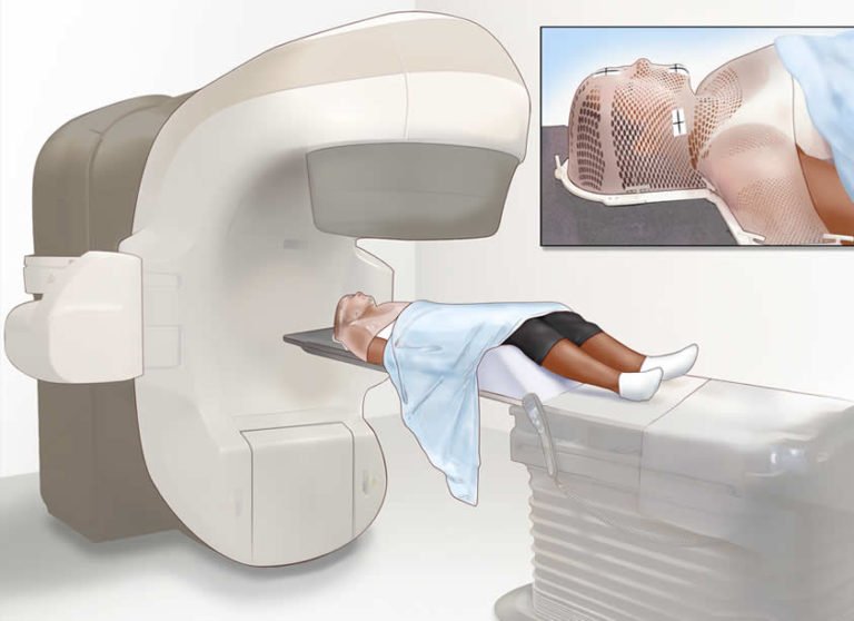 Nazofarenks Kanseri Nedir? Belirtileri Nelerdir? Dr. Altan Yıldırım Nazofarenks Kanseri Nedir? Belirtileri Nelerdir? Dr. Altan Yıldırım